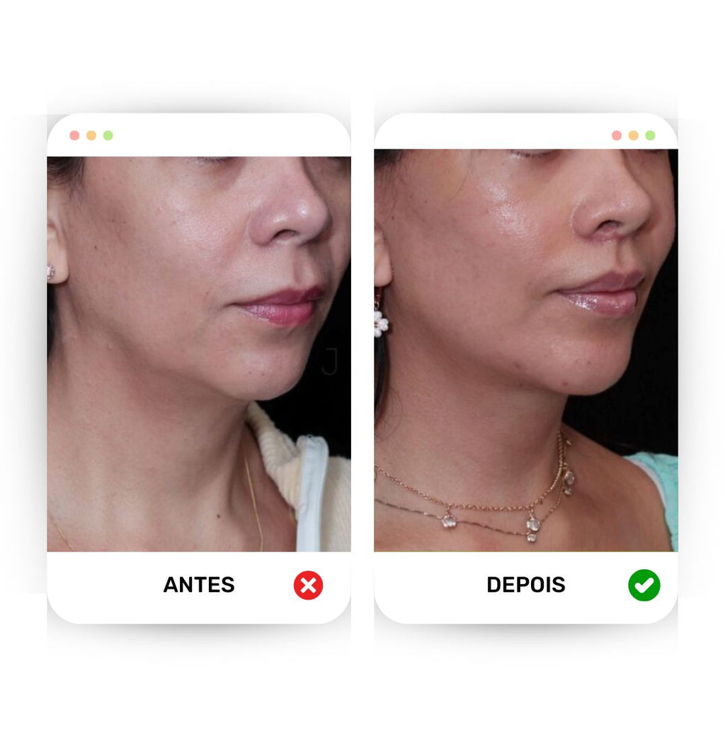 Lifting Face - Defina e modele o seu rosto!