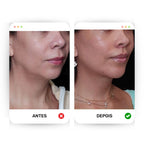Lifting Face - Defina e modele o seu rosto!