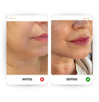 Lifting Face - Defina e modele o seu rosto!