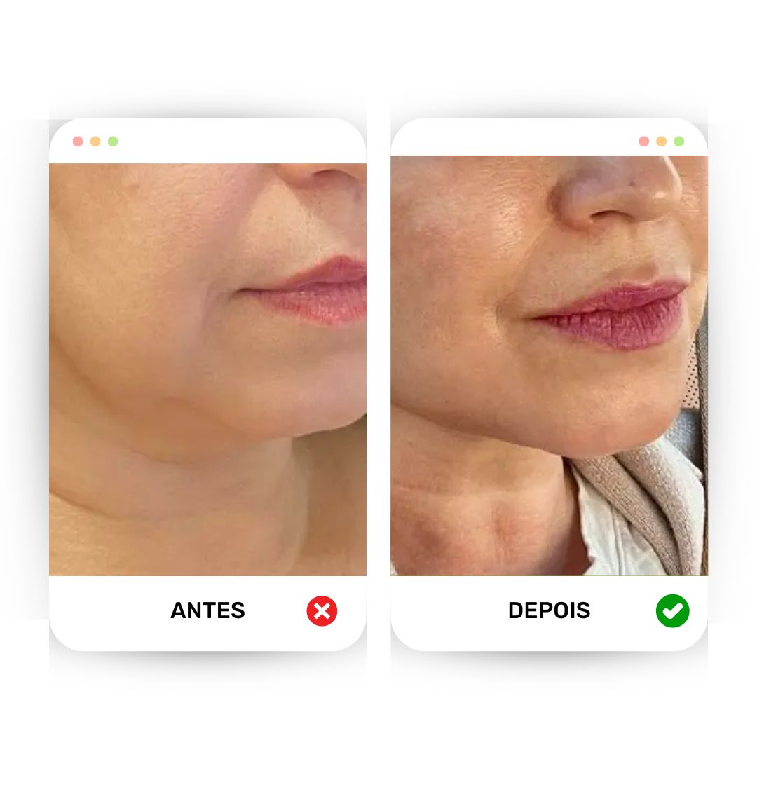Lifting Face - Defina e modele o seu rosto!