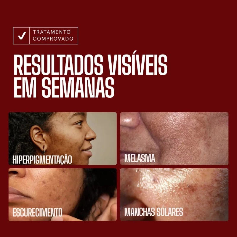 Sérum Envy Skin - Renove a sua pele em 24h! (Compre 1 Ganhe 2)